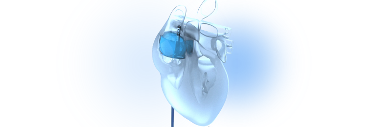 Lighting the Path of Cardiac Surgeries